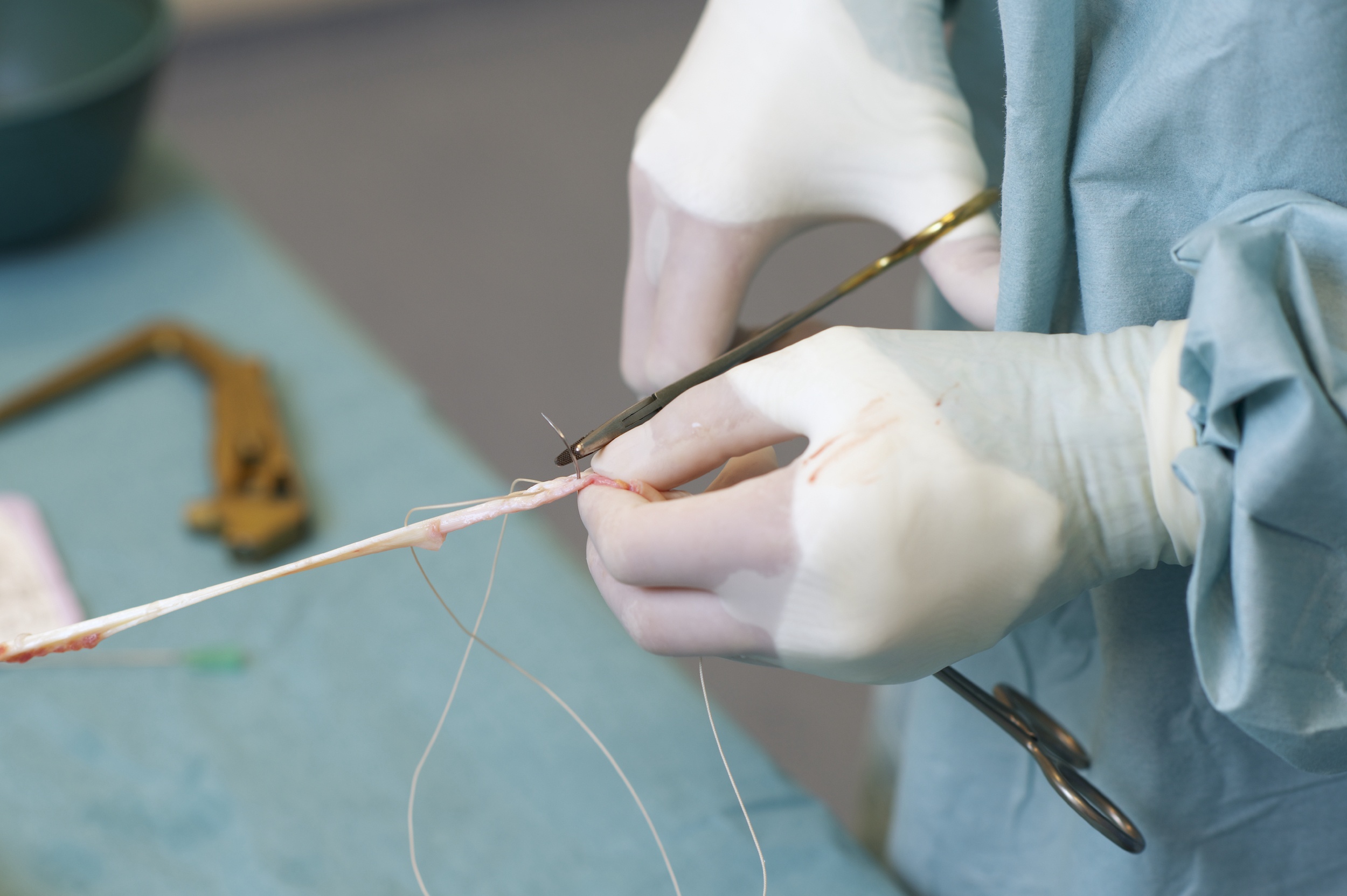 Welche Sehne fr die Kreuzbandplastik: Das sind die Mglichkeiten